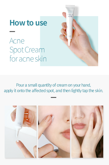 Acne Spot Cream  0.50 Fl. Oz,15ml