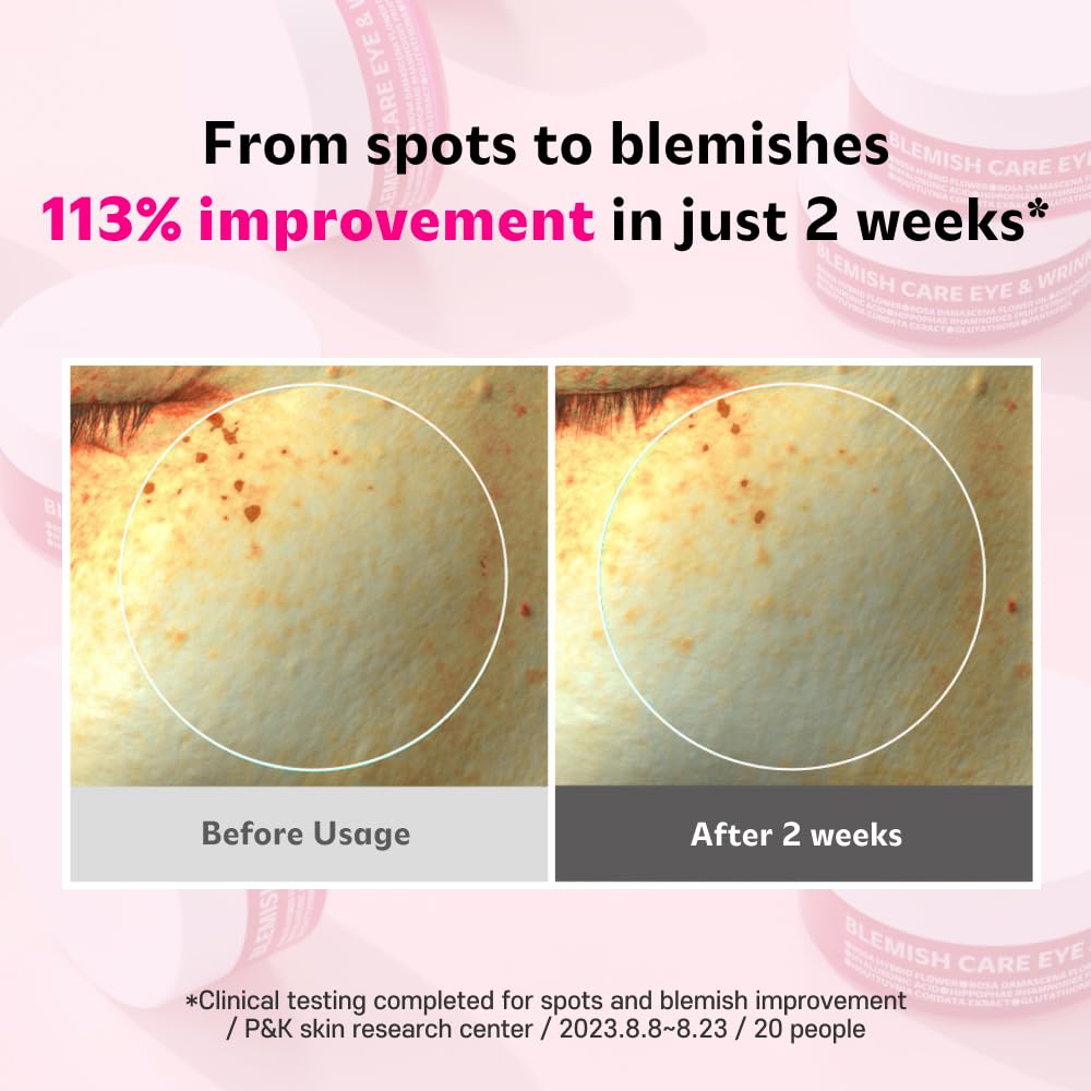 Blemish Care Eye & Wrinkle Patch 90g (90pcs)(sold out)