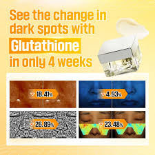 No.5 Vitamin Glutathione Dark Spot Laser Cream 50ml , 1.69 fl. oz.