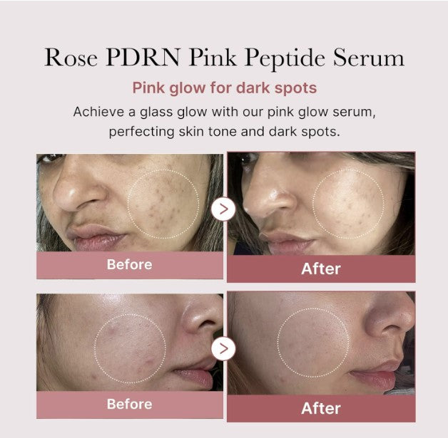 PDRN Pink Peptide Serum 30ml