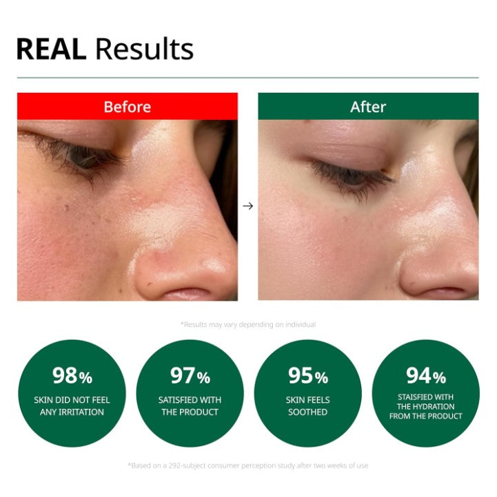 Red Blemish Clear Soothing Cream 70ml