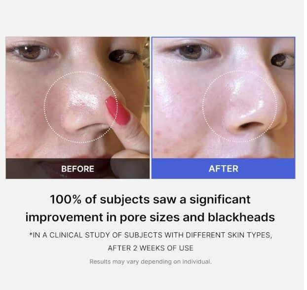 Zero Pore Pads 2.0 70 Pads